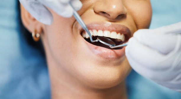 Best Emergency Dentist for Special Needs Patients in Missouri City, TX