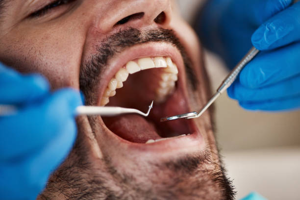Best Urgent Dental Care for Toothache in Missouri City, TX