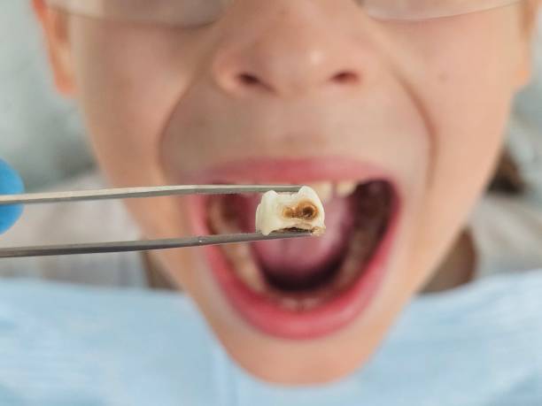 Best Emergency Dentist for Special Needs Patients in Missouri City, TX