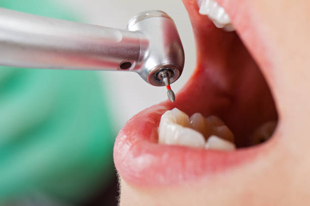 Best Mobile Emergency Dentist in Missouri City, TX
